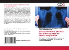 Couverture de Evaluación de la eficacia del nimotuzumab en cáncer de pulmón