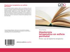 Bookcover of Hipotermia terapéutica en asfixia perinatal