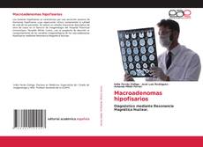 Buchcover von Macroadenomas hipofisarios