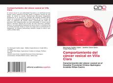 Buchcover von Comportamiento del cáncer vesical en Villa Clara