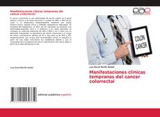 Обложка Manifestaciones clinicas tempranas del cancer colorrectal