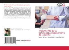 Capa do livro de Tratamiento de la condropatia degenerativa de la rodilla 