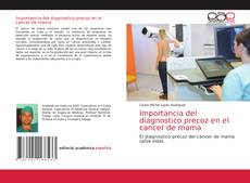 Bookcover of Importancia del diagnostico precoz en el cancer de mama