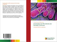 Buchcover von Avaliação da Microbiota de Feridas Crônicas