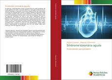 Síndrome coronária aguda的封面