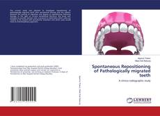 Copertina di Spontaneous Repositioning of Pathologically migrated teeth