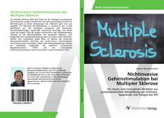 Copertina di Nichtinvasive Gehirnstimulation bei Multipler Sklerose