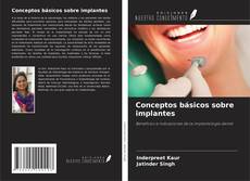 Borítókép a  Conceptos básicos sobre implantes - hoz