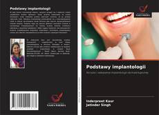 Borítókép a  Podstawy implantologii - hoz
