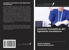 Lesiones traumáticas del ligamento escafolunar的封面