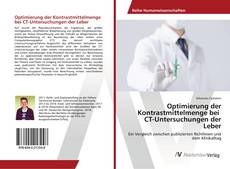 Buchcover von Optimierung der Kontrastmittelmenge bei CT-Untersuchungen der Leber
