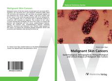Bookcover of Malignant Skin Cancers