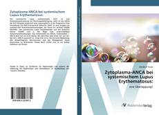 Copertina di Zytoplasma-ANCA bei systemischem Lupus Erythematosus: