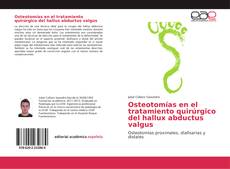 Buchcover von Osteotomías en el tratamiento quirúrgico del hallux abductus valgus