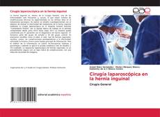 Обложка Cirugía laparoscópica en la hernia inguinal