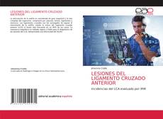 Bookcover of LESIONES DEL LIGAMENTO CRUZADO ANTERIOR