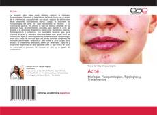 Acné:的封面