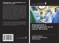 Copertina di Angiogénesis y linfangiogénesis en el cáncer de ovario