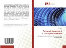 Bookcover of Tomoscintigraphie à l’111In-pentétréotide