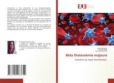 Buchcover von Béta thalassémie majeure