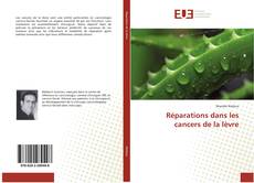 Copertina di Réparations dans les cancers de la lèvre