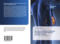 Buchcover von Microwave Ablation of Breast Cancerous Tumor Using A suitable Antenna