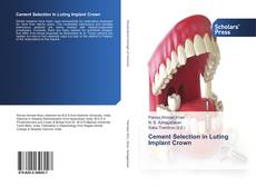 Buchcover von Cement Selection in Luting Implant Crown