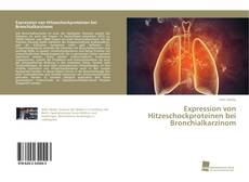 Portada del libro de Expression von Hitzeschockproteinen bei Bronchialkarzinom