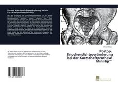Bookcover of Postop. Knochendichteveränderung bei der Kurzschaftprothese MiniHip™