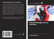 Capa do livro de Patomorfología de los tumores 