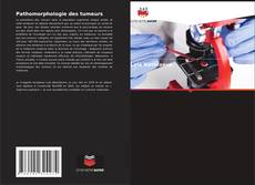 Обложка Pathomorphologie des tumeurs