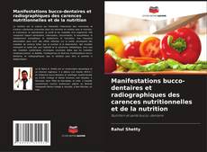 Buchcover von Manifestations bucco-dentaires et radiographiques des carences nutritionnelles et de la nutrition