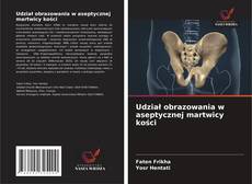 Couverture de Udział obrazowania w aseptycznej martwicy kości