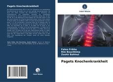 Обложка Pagets Knochenkrankheit