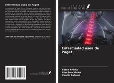 Capa do livro de Enfermedad ósea de Paget 
