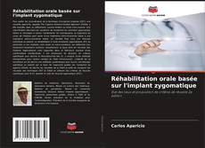 Bookcover of Réhabilitation orale basée sur l'implant zygomatique