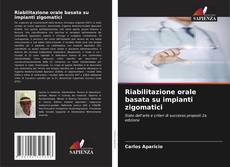 Couverture de Riabilitazione orale basata su impianti zigomatici