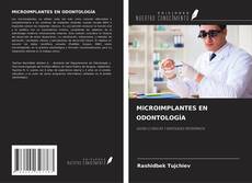 Copertina di MICROIMPLANTES EN ODONTOLOGÍA