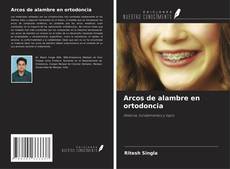 Copertina di Arcos de alambre en ortodoncia