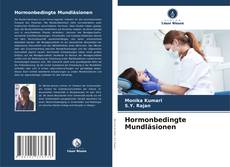 Bookcover of Hormonbedingte Mundläsionen