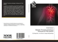 Maladie Thrombo-embolique Veineuse En Péri-partum kitap kapağı