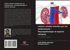 Borítókép a  Lésions rénales induites par les médicaments : Physiopathologie et aspects cliniques - hoz