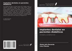 Couverture de Implantes dentales en pacientes diabéticos