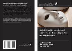 Couverture de Rehabilitación maxilofacial extraoral mediante implantes osteointegrados