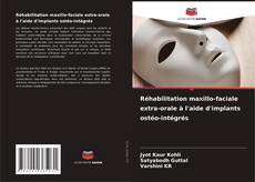 Borítókép a  Réhabilitation maxillo-faciale extra-orale à l'aide d'implants ostéo-intégrés - hoz