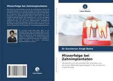 Couverture de Misserfolge bei Zahnimplantaten