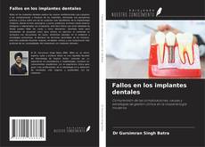 Buchcover von Fallos en los implantes dentales