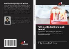 Fallimenti degli impianti dentali kitap kapağı