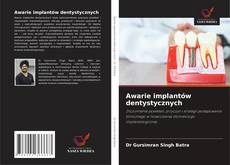 Awarie implantów dentystycznych的封面