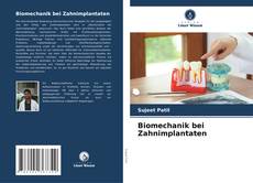 Portada del libro de Biomechanik bei Zahnimplantaten